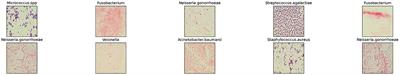 Machine learning algorithms in microbial classification: a comparative analysis